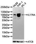 Western Blot
Positive WB detected in: NIH/3T3 whole cell lysate, HL60 whole cell lysate
All lanes: IL17RA antibody at 3.5µg/ml
Secondary
Goat polyclonal to rabbit IgG at 1/50000 dilution
Predicted band size: 97, 93 kDa
Observed band size: 93 kDa