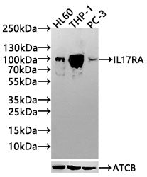 Western Blot
Positive WB detected in: NIH/3T3 whole cell lysate, HL60 whole cell lysate
All lanes: IL17RA antibody at 3.5µg/ml
Secondary
Goat polyclonal to rabbit IgG at 1/50000 dilution
Predicted band size: 97, 93 kDa
Observed band size: 93 kDa