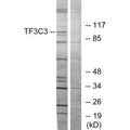 Western blot analysis of extracts from 293 cells, using TF3C3 antibody.