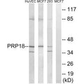 Western blot analysis of extracts from HuvEc cells, MCF-7 cells and 293 cells, using PRPF18 antibody.