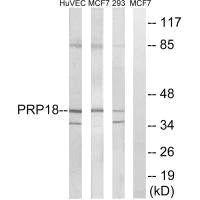 Western blot analysis of extracts from HuvEc cells, MCF-7 cells and 293 cells, using PRPF18 antibody.