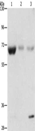 Gel: 8%SDS-PAGE, Lysate: 40 ug, Lane 1-3: Human fetal muscle tissue, Human kidney tissue, Human liver tissue, Primary antibody: CSB-PA131191(NAE1 Antibody) at dilution 1/500, Secondary antibody: Goat anti rabbit IgG at 1/8000 dilution, Exposure time: 1 minute