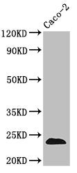 Western Blot
Positive WB detected in: Caco-2 whole cell lysate
All lanes: CLDN3 antibody at 3.5µg/ml
Secondary
Goat polyclonal to rabbit IgG at 1/50000 dilution
Predicted band size: 24 kDa
Observed band size: 24 kDa