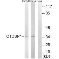 Western blot analysis of extracts from HUVEC cells and HeLa cells, using CTDSP1 antibody.