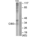 Western blot analysis of extracts from K562 cells, using CIB3 antibody.