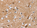 The image on the left is immunohistochemistry of paraffin-embedded Human brain tissue using CSB-PA133797(MAD1L1 Antibody) at dilution 1/25, on the right is treated with fusion protein. (Original magnification: ×200)