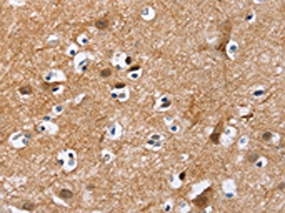 The image on the left is immunohistochemistry of paraffin-embedded Human brain tissue using CSB-PA133797(MAD1L1 Antibody) at dilution 1/25, on the right is treated with fusion protein. (Original magnification: ×200)