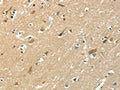 The image on the left is immunohistochemistry of paraffin-embedded Human brain tissue using CSB-PA133826(ASAH2 Antibody) at dilution 1/50, on the right is treated with fusion protein. (Original magnification: ×200)