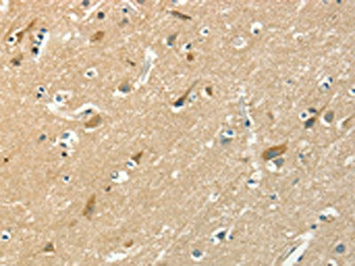 The image on the left is immunohistochemistry of paraffin-embedded Human brain tissue using CSB-PA133826(ASAH2 Antibody) at dilution 1/50, on the right is treated with fusion protein. (Original magnification: ×200)