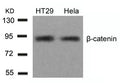 Western blot analysis of extracts from HT29 and Hela cells using b-Catenin(Ab-654) Antibody.