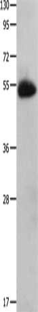 Gel: 10%SDS-PAGE, Lysate: 60 ug, Lane: Human fetal muscle tissue, Primary antibody: CSB-PA135132(CX3CR1 Antibody) at dilution 1/200, Secondary antibody: Goat anti rabbit IgG at 1/8000 dilution, Exposure time: 1 minute