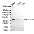 Western Blot
Positive WB detected in: recombinant protein
All lanes: SYP121 Antibody at 1:1000
Secondary
Goat polyclonal to rabbit IgG at 1/50000 dilution
Predicted band size: 39 kDa
Observed band size: 39 kDa