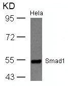 Western blot analysis of extracts from Hela cells using Smad1(Ab-465) Antibody.
