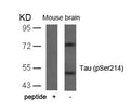 Western blot analysis of extracts from mouse brain tissue using Tau(Phospho-Ser214) Antibody and the same antibody preincubated with blocking peptide.