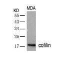 Western blot analysis of extracts from MDA cells using cofilin(Ab-3) Antibody.