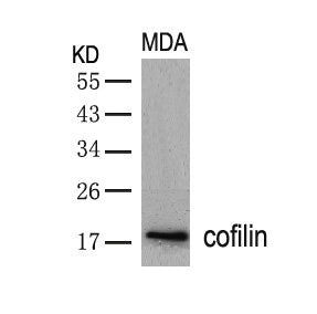 Western blot analysis of extracts from MDA cells using cofilin(Ab-3) Antibody.