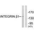 Western blot analysis of extracts from Jurkat cells, using Integrin β1 (Ab-789) antibody.