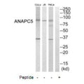 Western blot analysis of extracts from HeLa cells, Jurkat cells and COLO205 cells, using ANAPC5 antibody.