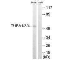 Western blot analysis of extracts from Rat brain cells, using TUBA1/3/4 (Ab-272) antibody.