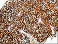 The image is immunohistochemistry of paraffin-embedded Human tonsil tissue using CSB-PA138308(TLR7 Antibody) at dilution 1/10. (Original magnification: 200)