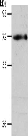 Gel: 10%SDS-PAGE, Lysate: 40 ug, Lane: Human fetal brain tissue, Primary antibody: CSB-PA138359(EGFL6 Antibody) at dilution 1/450, Secondary antibody: Goat anti rabbit IgG at 1/8000 dilution, Exposure time: 20 seconds