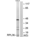Western blot analysis of extracts from COLO cells, using RPL36 antibody.