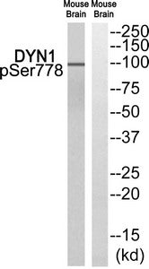 Western blot analysis of extracts from Mouse brain cells, using DYN1 (Phospho-Ser778) antibody. The lane on the right is treated with the synthesized peptide.