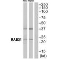 Western blot analysis of extracts from HeLa cells and  HepG2 cells, using RAB31 antibody.