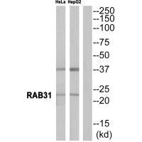 Western blot analysis of extracts from HeLa cells and  HepG2 cells, using RAB31 antibody.