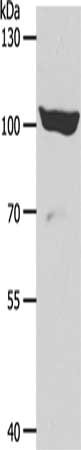 Gel: 8%SDS-PAGE, Lysate: 40 ug, Lane: 293T cells, Primary antibody: CSB-PA139279(ADAMTS15 Antibody) at dilution 1/600, Secondary antibody: Goat anti rabbit IgG at 1/8000 dilution, Exposure time: 30 minutes