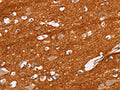 The image on the left is immunohistochemistry of paraffin-embedded Human brain tissue using CSB-PA139477(IGSF8 Antibody) at dilution 1/15, on the right is treated with fusion protein. (Original magnification: ×200)