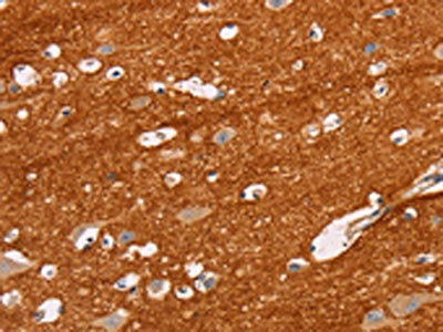 The image on the left is immunohistochemistry of paraffin-embedded Human brain tissue using CSB-PA139477(IGSF8 Antibody) at dilution 1/15, on the right is treated with fusion protein. (Original magnification: ×200)