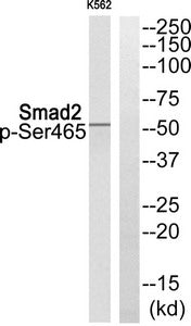 Western blot analysis of extracts from K562 cells using Smad2 (Phospho-Ser465) Antibody.The lane on the right is treated with the antigen-specific peptide.