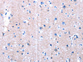 The image on the left is immunohistochemistry of paraffin-embedded Human brain tissue using CSB-PA140473(LAMA3 Antibody) at dilution 1/10, on the right is treated with synthetic peptide. (Original magnification: ×200)