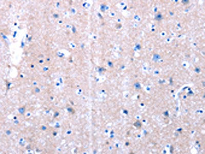 The image on the left is immunohistochemistry of paraffin-embedded Human brain tissue using CSB-PA140473(LAMA3 Antibody) at dilution 1/10, on the right is treated with synthetic peptide. (Original magnification: ×200)