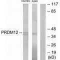 Western blot analysis of extracts from HUVEC cells and A549 cells, using PRDM12 antibody.