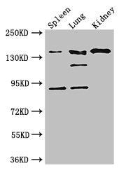 Western Blot
Positive WB detected in: Mouse spleen tissue, Mouse lung tissue, Mouse kidney tissue
All lanes: NOS1 antibody at 3ug/ml
Secondary
Goat polyclonal to rabbit IgG at 1/50000 dilution
Predicted band size: 161, 149, 126, 44, 165 kDa
Observed band size: 161, 126, 92 kDa