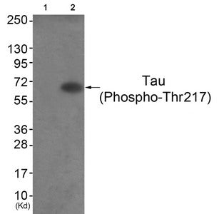 Western blot analysis of extracts from HepG2 cells (Lane 2), using Tau (Phospho-Thr217) Antibody. The lane on the left is treated with antigen-specific peptide.