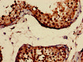 Immunohistochemistry of paraffin-embedded human testis tissue using CSB-PA14169A0Rb at dilution of 1:100