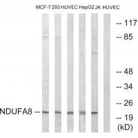 Western blot analysis of extracts from MCF-7 cells, 293 cells, HUVEC cells, HepG2 cells and Jurkat cells, using NDUFA8 antibody.
