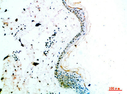 Immunohistochemical analysis of paraffin-embedded human-skin, antibody was diluted at 1:200