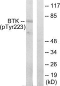 Western blot analysis of extracts from Hela cells treated with serum using BTK (phospho-Tyr223) Antibody.The lane on the right is treated with the antigen-specific peptide.