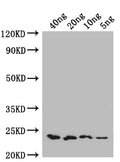 Western Blot
Positive WB detected in: recombinant protein
All lanes: ENT1 Antibody at 1:1000
Secondary
Goat polyclonal to rabbit IgG at 1/50000 dilution
Predicted band size: 22 kDa
Observed band size: 22 kDa