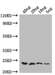 Western Blot
Positive WB detected in: recombinant protein
All lanes: ENT1 Antibody at 1:1000
Secondary
Goat polyclonal to rabbit IgG at 1/50000 dilution
Predicted band size: 22 kDa
Observed band size: 22 kDa