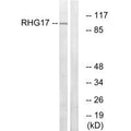 Western blot analysis of extracts from LOVO cells, using RHG17 antibody.