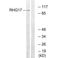 Western blot analysis of extracts from LOVO cells, using RHG17 antibody.