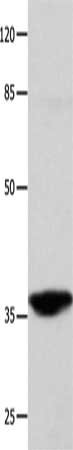 Gel: 10%SDS-PAGE, Lysate: 40 ug, Lane: Mouse brain tissue, Primary antibody: CSB-PA142349(CTSG Antibody) at dilution 1/450, Secondary antibody: Goat anti rabbit IgG at 1/8000 dilution, Exposure time: 10 seconds