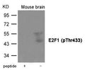 Western blot analysis of extracts from  Mouse brain tissue using E2F1 (Phospho-Thr433) Antibody.The lane on the left is treated with the antigen-specific peptide.