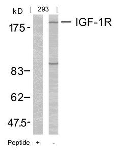 Western blot analysis of extracts from 293 cells using IGF-1R(Ab-1165/1166) Antibody and the same antibody preincubated with blocking peptide.
