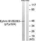 Western blot analysis of extracts from K562 cells treated with serum using Ephrin B1/B2/B3 (Phospho-Tyr324) Antibody.The lane on the right is treated with the antigen-specific peptide.
